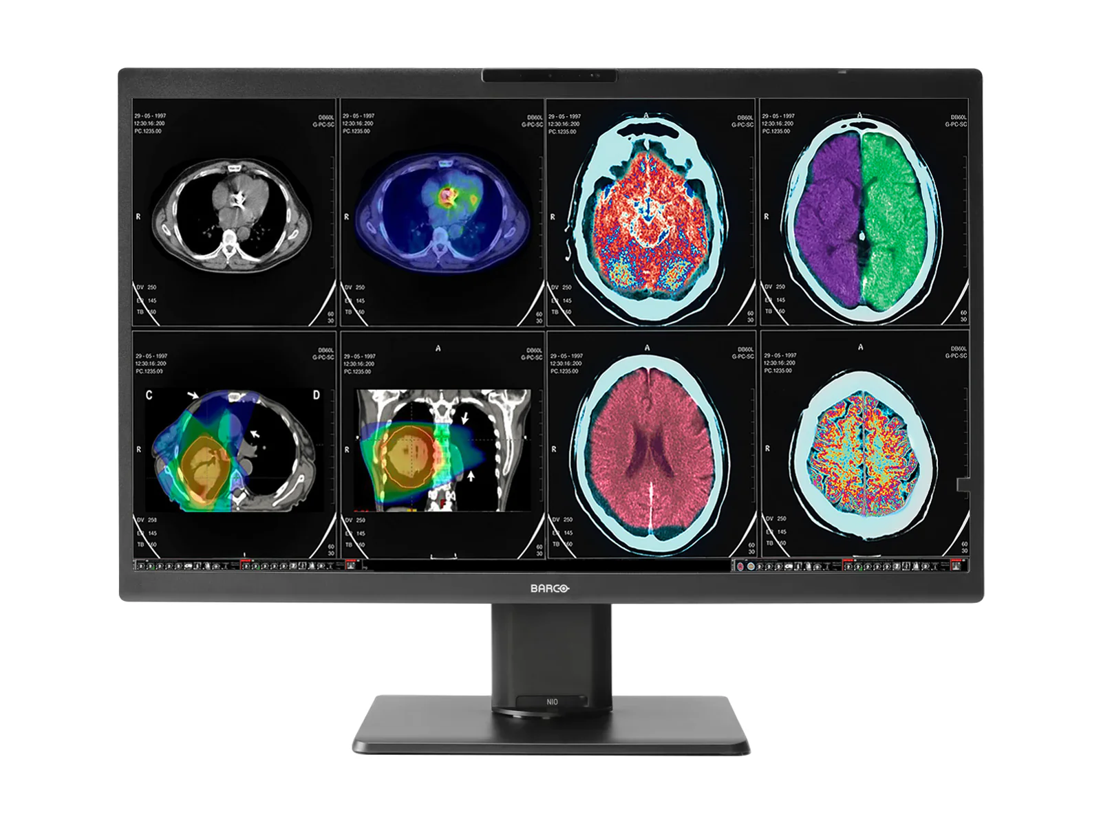 Best Selling Medical Monitors