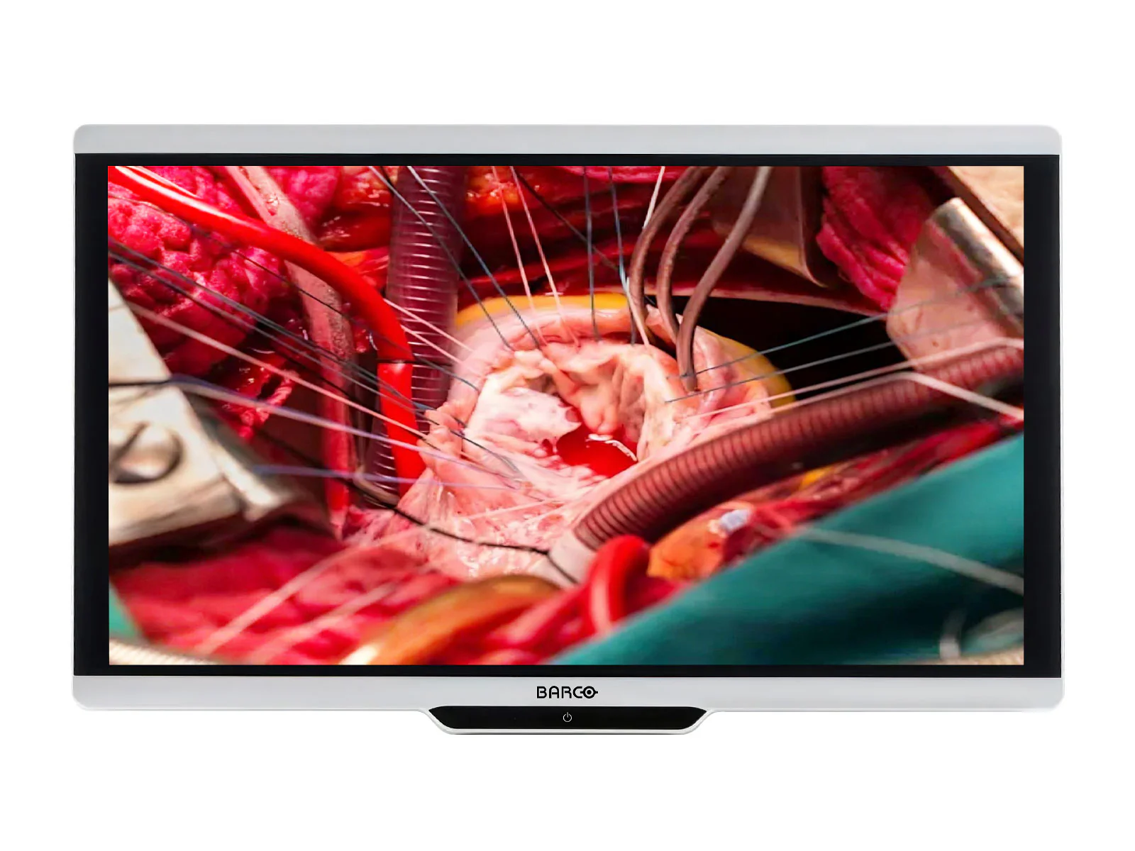 Best-Selling Surgical Displays