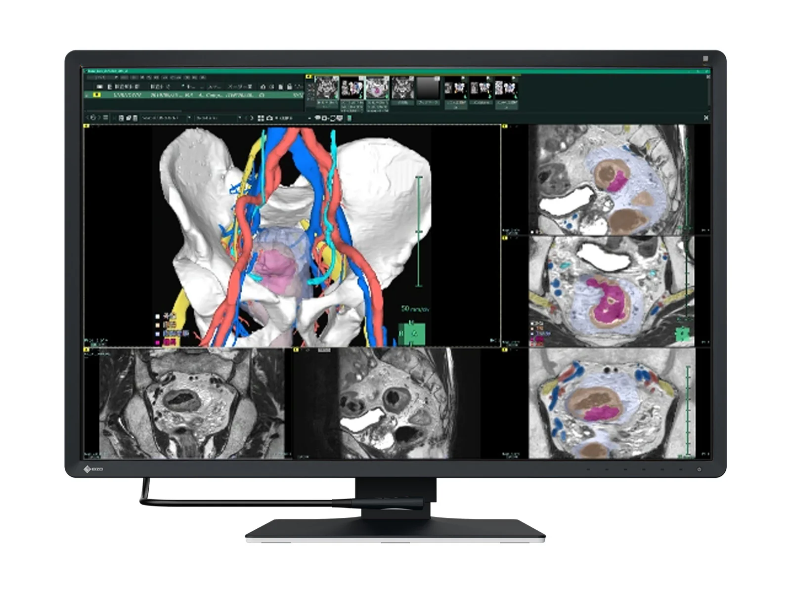 Best-Selling General Radiology Displays